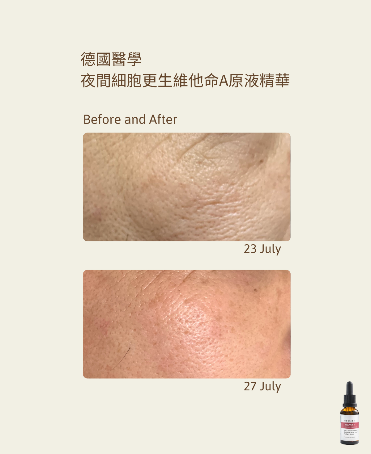 Vitamin A Cell Repair Serum 30ml